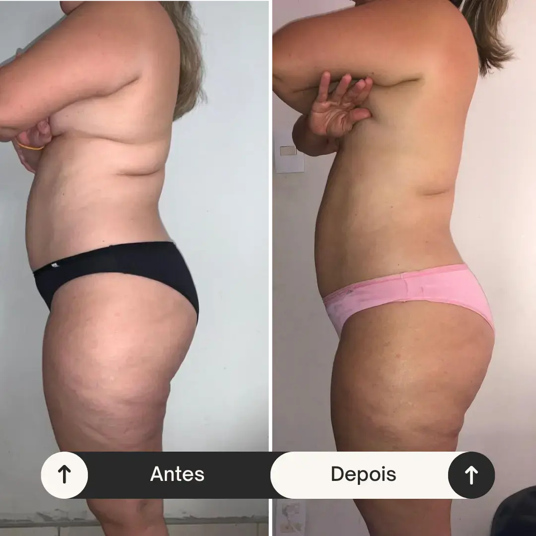 Antes (1) (1)