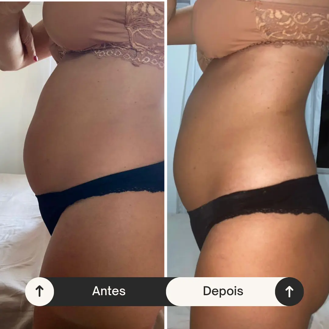 Antes 3