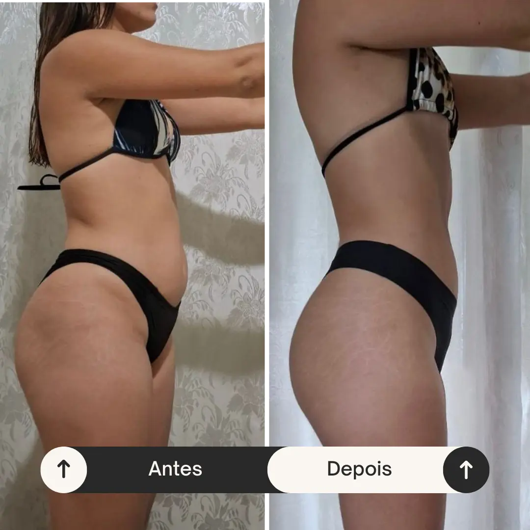 Antes 3 (1)